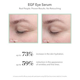 BIOEFFECT EGF Eye Serum with De-Puffer Rollerball | Age-Defying Under Eye Treatment with Epidermal Growth Factor for Fine Lines, Wrinkles, Puffiness & Sagging 6 mL / 0.20 oz