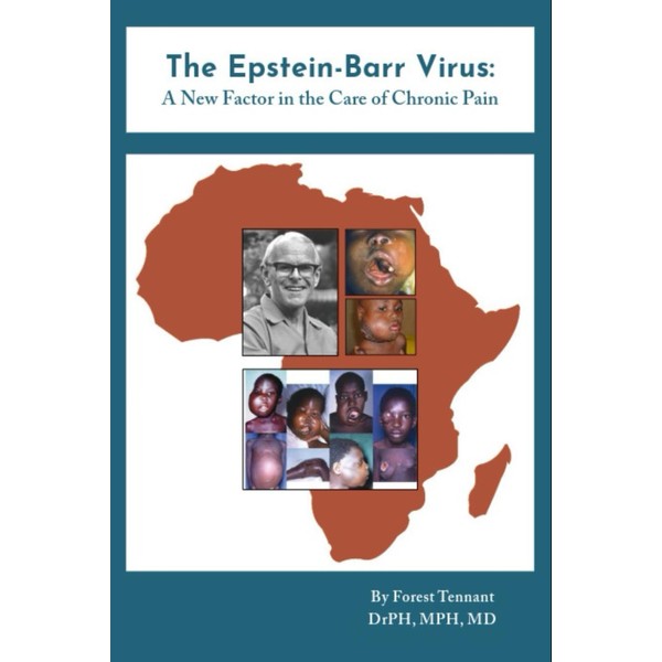 The Epstein-Barr Virus:: A New Factor in the Care of