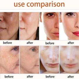 Turmeric & Lemon Kojic Acid Soap Bar for Fine Lines - Deep Cleansing & Brightening - Smooth Skin & Dark Spot Corrector