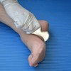 NCCYOOT Gua sha tool gua sha stainless steel iastm tool