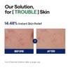 MEDIHEAL Teatree Calming Serum - Soothing & Moisturizing Care. Hyaluronic