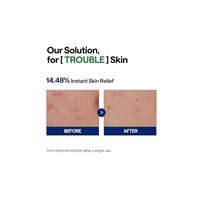 MEDIHEAL Teatree Calming Serum - Soothing & Moisturizing Care. Hyaluronic
