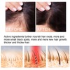 30ml 4PCS Ginger Hair Growth Spray Nutritious Moisturizing Hair Root
