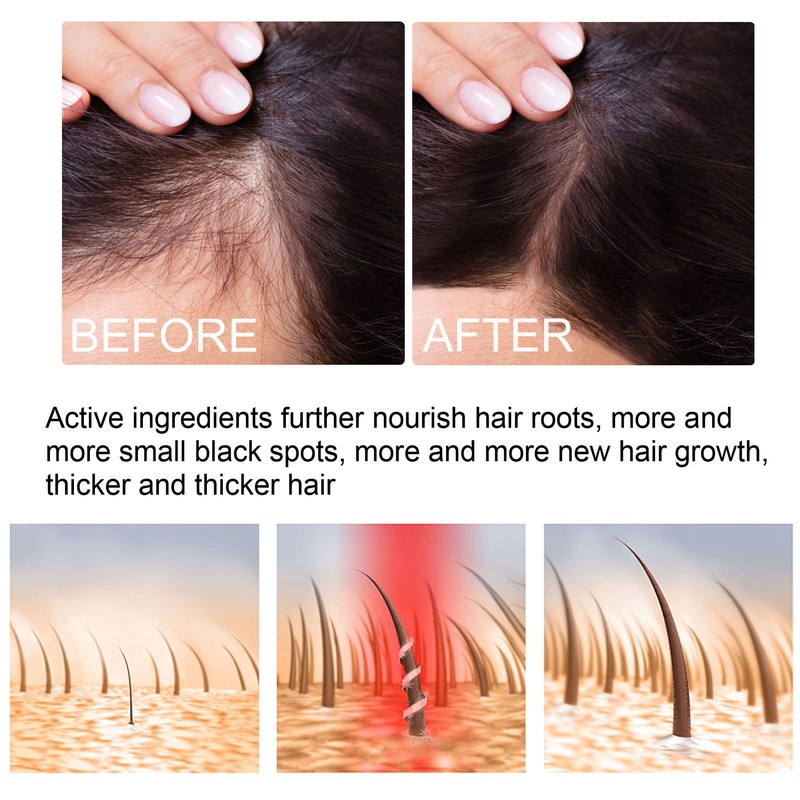 30ml 4PCS Ginger Hair Growth Spray Nutritious Moisturizing Hair Root
