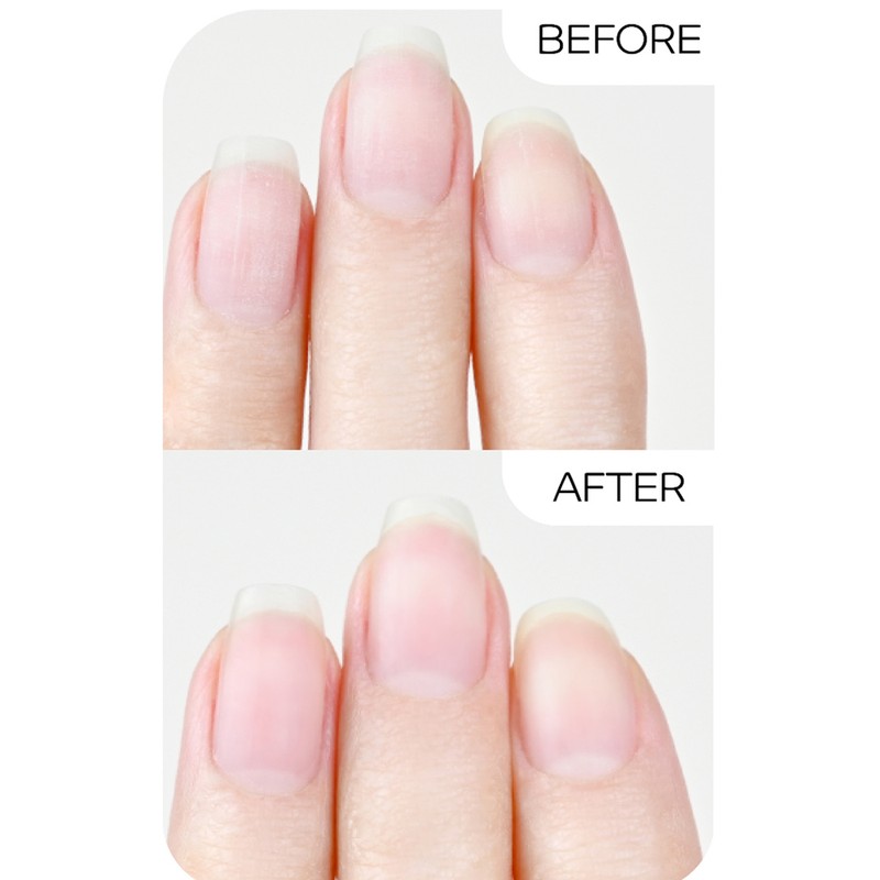 Facet Repair Nail Serum 7ml Nail Care / 파셋 리페어