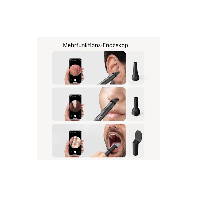 Bebird HD Model R1 ENT Kit – 3-in-1 Ear, Nose,