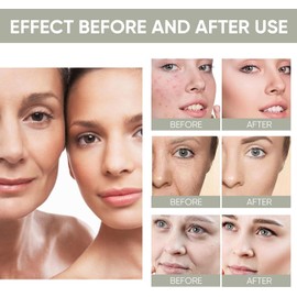 Tónico Ácido Glicólico 7% Exfoliante Hidratante Limpia, Reduce Poros, Tensa, Suave