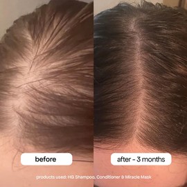 Bondi Boost Anti-Thinning Trio Bundle
