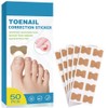 50 Piezas de Parche para Uñas Encarnadas – Soporte Natural