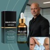 Crema Hidratante Hialurónica Para Cuero Cabelludo Bald Care