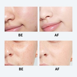 Youthful Formula Ultimate Moisturizing Cream, Korean Gel, Youthful Formula Moisturizing Cream,For All Skin Types 3pcs