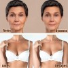 Parches Antiarrugas De Silicona Grado Médico Skin Lift