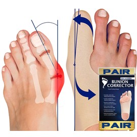 Bunion Bootie - Bunion Corrector for Women Big Toe - Ultra Thin Bunion Corrector - Comfortable Bunion Shoe Insert - Compression Bunion Sock Ideal For Active Women and Athletes - Small (PAIR)