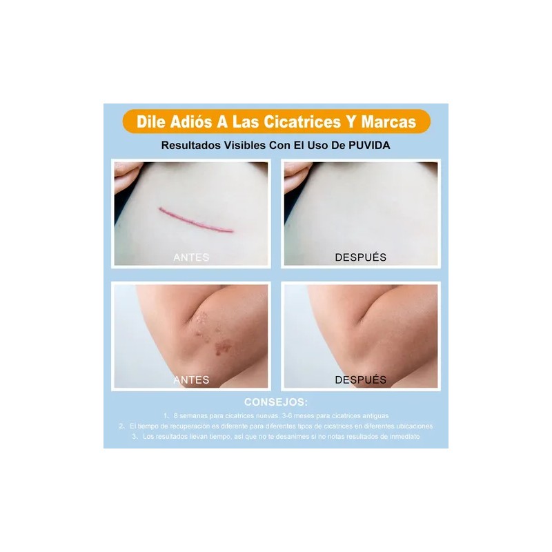 Crema Cicatricial De Minimizar Y Reducir Las Cicatrices 20g