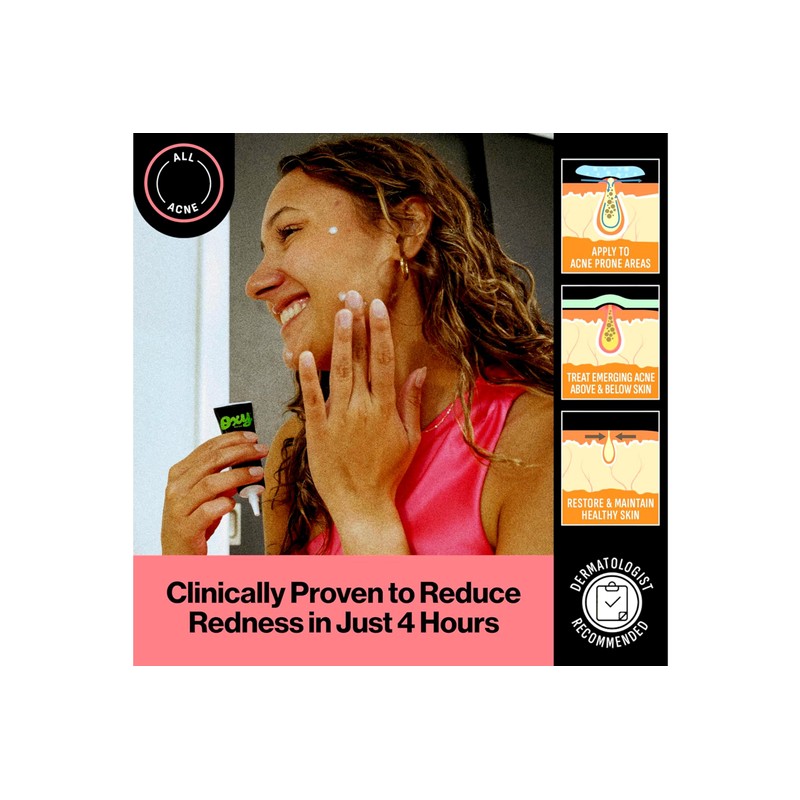 Oxy Maximum Strength Acne Spot Treatment - 1 oz Tube