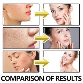 Grass-Fed Beef Tallow with Frankincense Oil and Castor Oil,Beef Tallow Moisturiser,Tallow and Honey Balm,Natural Beef Tallow Face Cream,Beef Tallow Skin Care for All Type Skins,Face Cream for Women