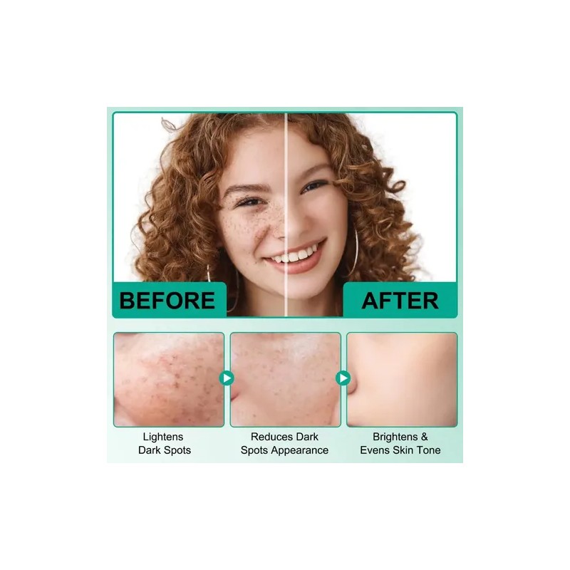 Serum Facial Manchas Oscuras Niacinamida Retinol 50ml Crema