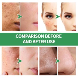 Mascarilla de espuma para el cuidado de la piel, 12 unidades control de aceite hidratante, limpieza profunda, máscara de espuma purificadora de burbujas
