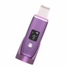 Skin Scrubber Face Spatula Positive Ion Vibration Blackhead Remover 4