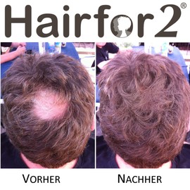 Hairfor2 Haarverdichtungsspray gegen lichtes Haar | Haarpuder | Streuhaar | Haarauffüller | Haarausfall | Haarverdichter (300ml, Kastanienbraun)