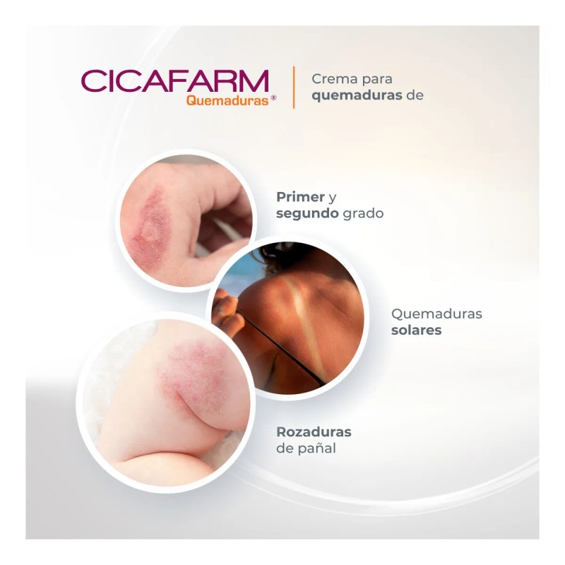 Crema Cicatrizante Quemaduras Superficiales Cicafarm