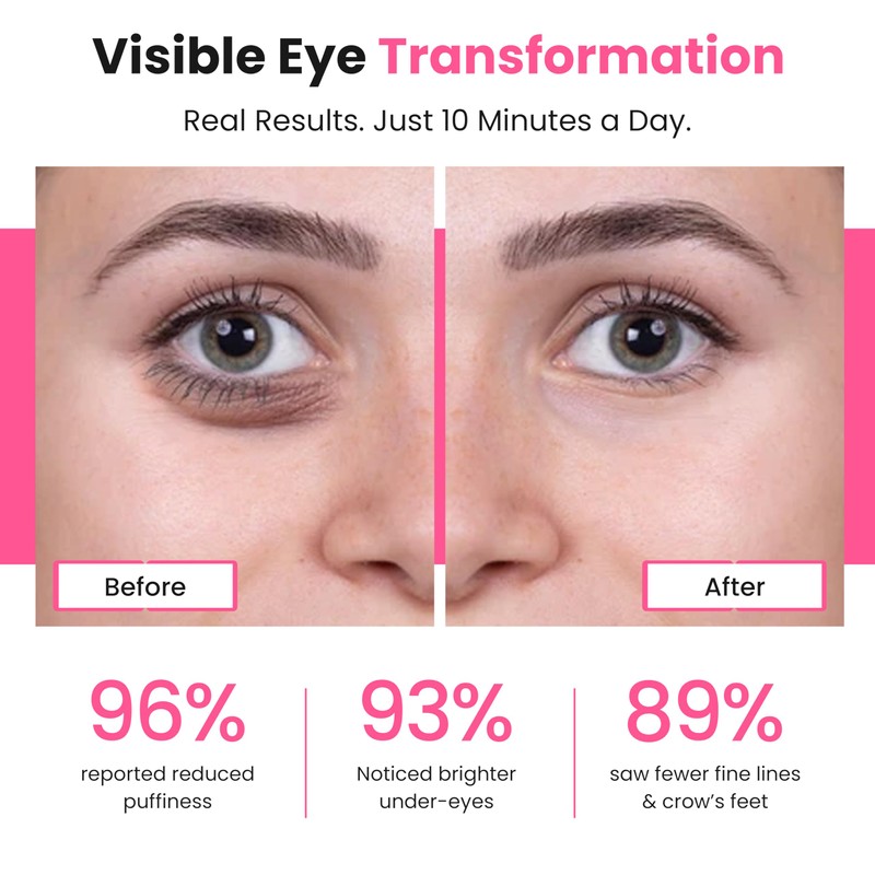 Bèa Eye Revitalize – Red Light Therapy for Dark Circles