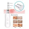 Makegina Limpiador Facial Peeling Ultrasónico Portatil Skin Scrubber
