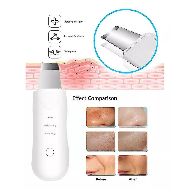 Makegina Limpiador Facial Peeling Ultrasónico Portatil Skin Scrubber