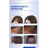 Aceite Enrollable Thick Hair Scalp Essence, 3 Unidades