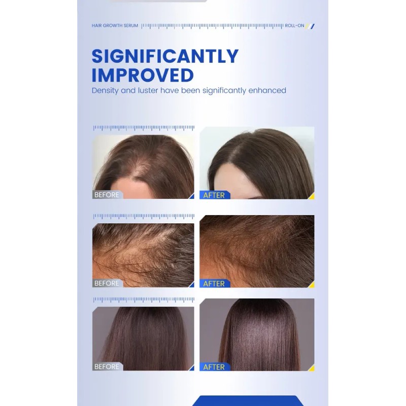 Aceite Enrollable Thick Hair Scalp Essence, 3 Unidades