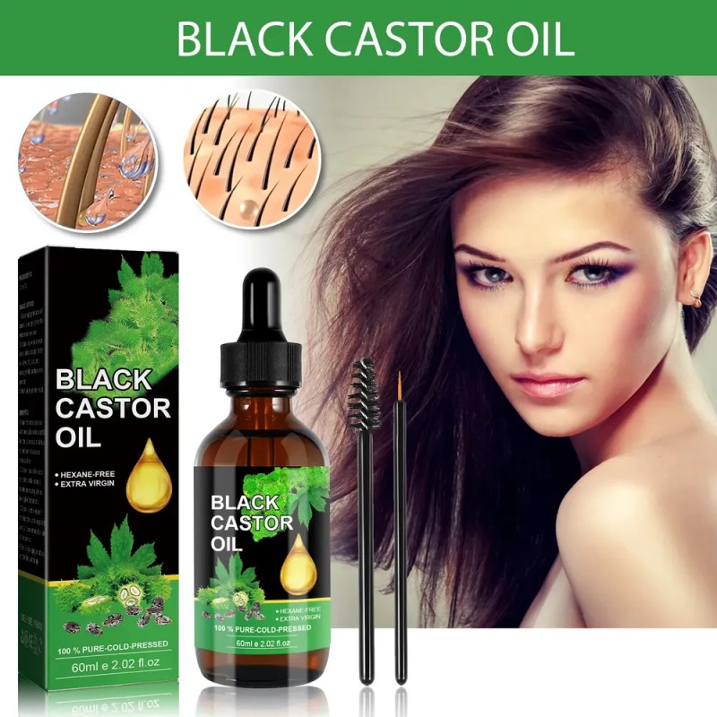 M El Sérum Capilar Con Aceite De Ricino Ouhoe De