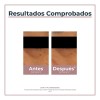Eucerin Anti-pigment Crema Contorno De Ojos Anti-ojeras 15ml