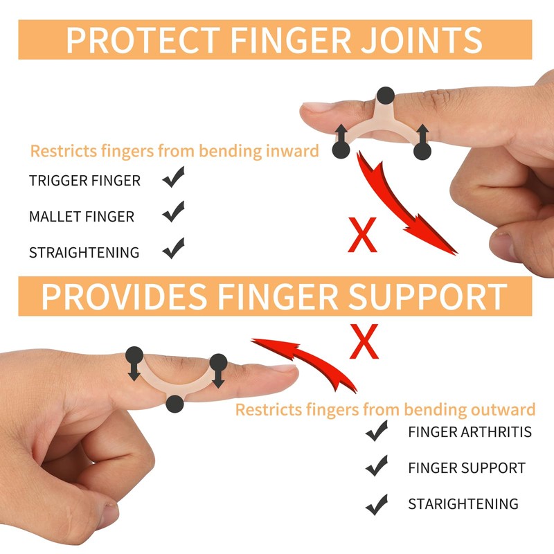 CAGSIG Oval Finger Splints, 5PCS Oval Trigger Finger Splint for