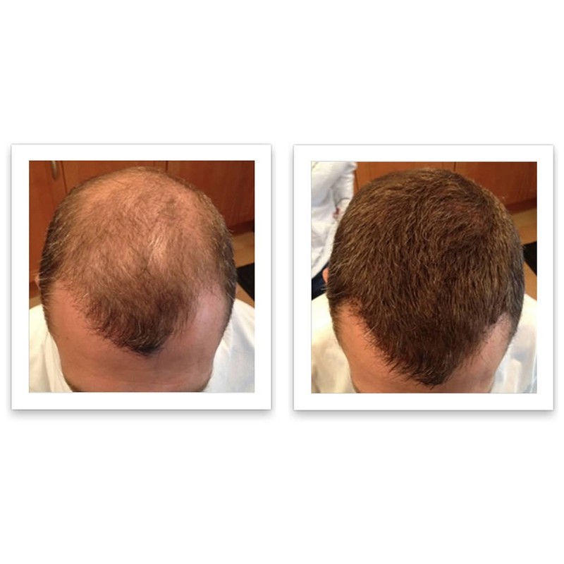 Caboki Hair Loss Concealer Trial Pack (Light Auburn)