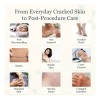 Cream, Growth Factor Skin Repair For Cracked Heels, Hands,