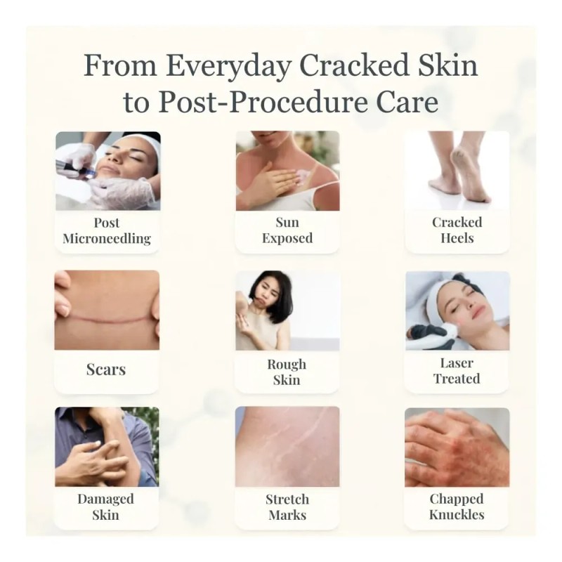 Cream, Growth Factor Skin Repair For Cracked Heels, Hands,