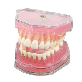 Dentalmall® 1 pieza Dental Demonstration Dientes Modelo – Enseñanza estándar modo dental con todos los dientes extraíbles #4004 01