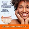 Palmer’s Skin Success Extra Strength Suero Corrector de Tono, Ayuda