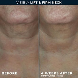 Roc Derm Correxion Neck Cream With Hyaluronic Acid And Advanced Retinol Visibly Tighten Lift Horizontal Lines Facial Moisturiser Contour Face Jawline