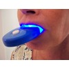 NiceWhites, Professional Teeth Whitening "Mini Blue" Light to Strengthen and