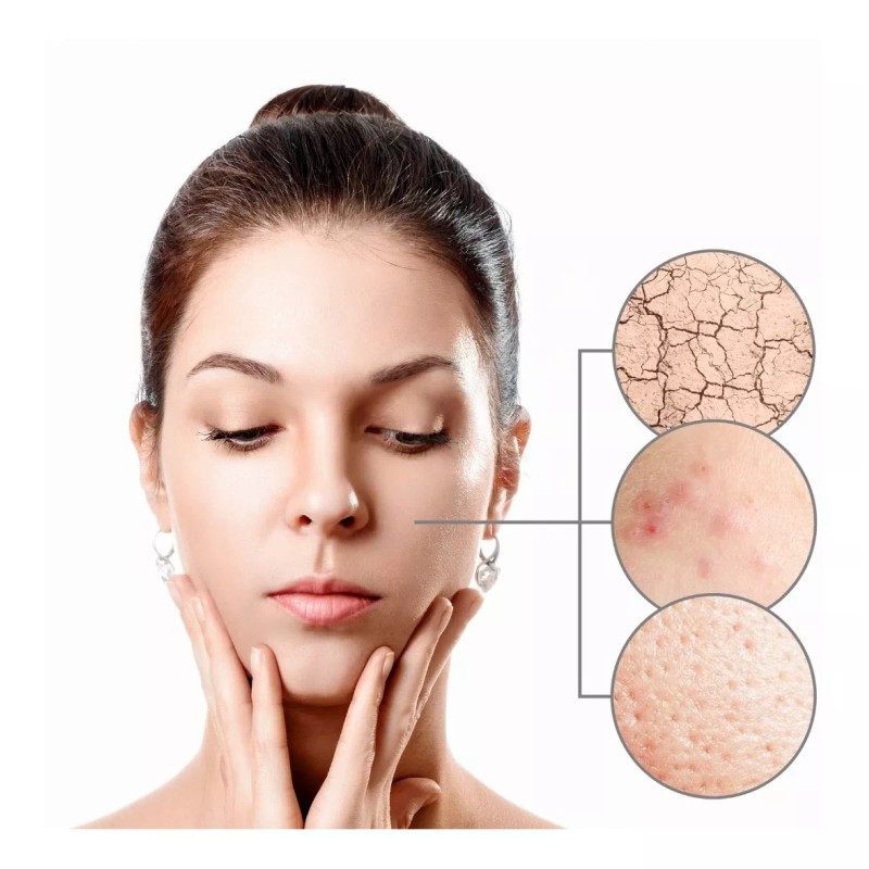 Beohemp Kit Jabón Facial, Loción, Crema De Día, Para Piel