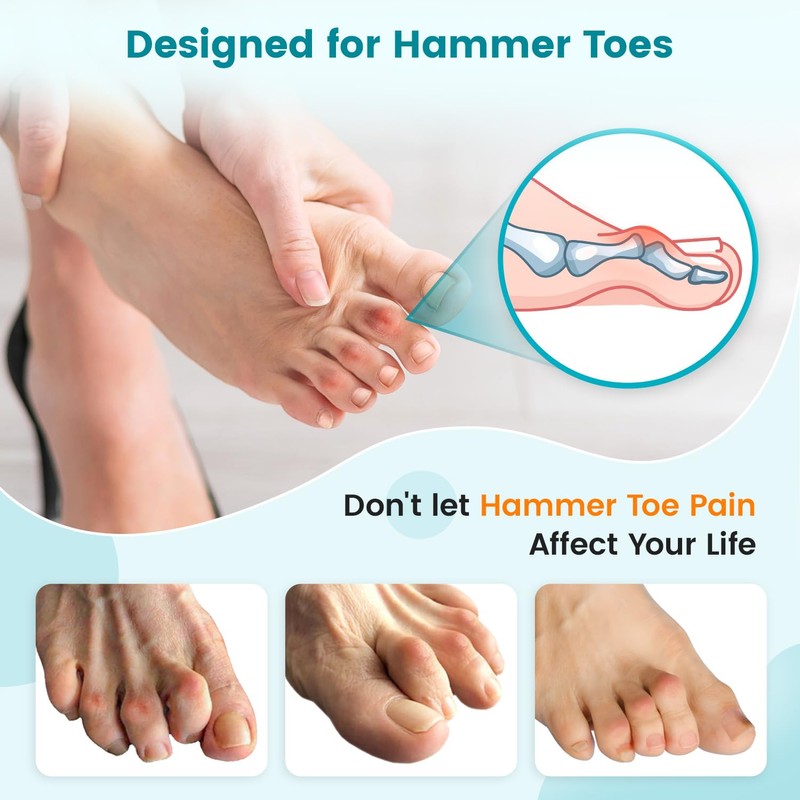 Pozpo Tech Hammer Toe Straightener Corrector Splint Brace for Women