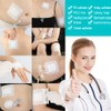 Breathable Knee Replacement Surgery Island Wound Dressing Long Incisions Bordered