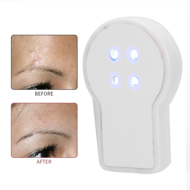 USB Plug In Mini Handheld Acne Removal Machine Blue Light