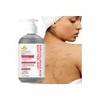 Gel Corporal Exfoliante Ácido Hipocloroso 200ml No