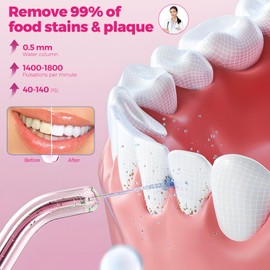 Water Flosser for Teeth Cordless & Oral Irrigator Dental Flosser, 350ML Portable flossers for Teeth Care Home Use and Travel, 3 Modes, Rosy Red
