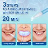Shynova Teeth Bleaching Set for White Teeth: Teeth Whitening Kit