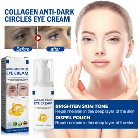 Jasmin Salbe Augenringe Gegen,Aktiv Jasminsalbe Augenringe Schlupflider,Augenringe Entfernen Augencreme Mit Collagen,Augencreme Mit Collagen Und Aloe Vera,Jasmin Salbe Augenringe Gegen