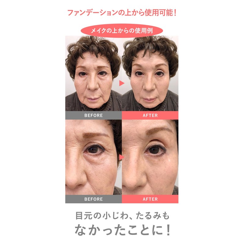 MIRACOCO (ミラココ) 【公式】 リンクルール 15g ｜クリーム 顔 目元ケア 目元クリーム おでこ