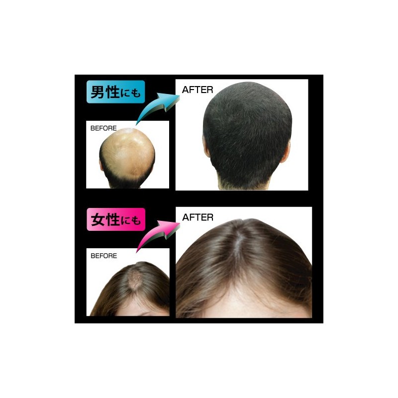 DEXE Hair Building Fibers, Dark Brown, 0.8 oz (22 g)